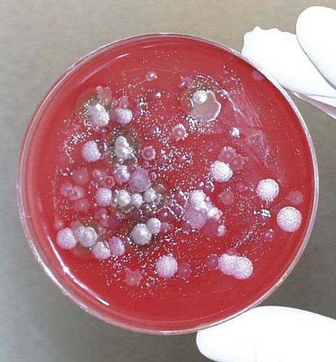 A culture of Bacillus anthracis, the causative agent of anthrax.